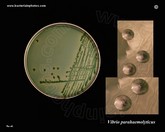 Vibrio parahaemolyticus on T.C.B.S. agar
